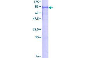Image no. 1 for Heterogeneous Nuclear Ribonucleoprotein K (HNRNPK) (AA 1-463) protein (GST tag) (ABIN1306879)