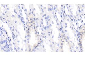 Detection of BMP3 in Bovine Kidney Tissue using Monoclonal Antibody to Bone Morphogenetic Protein 3 (BMP3)