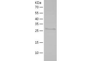 Western Blotting (WB) image for Ribosomal Protein S3A (RPS3A) (AA 1-264) protein (His-IF2DI Tag) (ABIN7124900)