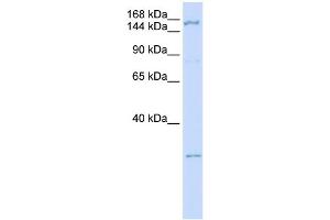 WB Suggested Anti-ZNF687 Antibody Titration:  0. (ZNF687 anticorps  (C-Term))