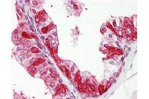 Anti-ZNF385A / ZNF385 antibody IHC of human prostate. (ZNF385A anticorps  (N-Term))
