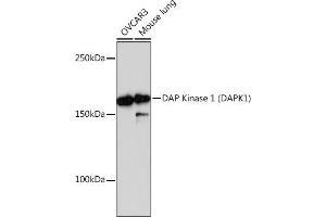 Western blot analysis of extracts of various cell lines, using DAP Kinase 1 (D) Rabbit mAb (ABIN7266711) at 1:1000 dilution. (DAP Kinase 1 anticorps)