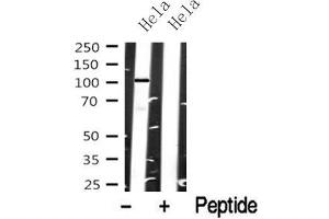 Western blot analysis of EPHA8 in lysates of Hela, using EPHA8 Antibody(ABIN6272805). (EPH Receptor A8 anticorps  (Internal Region))
