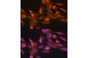 Immunofluorescence analysis of NIH-3T3 cells using RheB Rabbit mAb (ABIN7269863) at dilution of 1:100 (40x lens).
