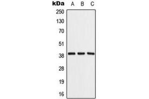 Western blot analysis of ALDOB expression in Raji (A), NIH3T3 (B), rat liver (C) whole cell lysates. (ALDOB anticorps  (Center))