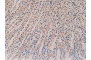 IHC-P analysis of Rat Stomach Tissue, with DAB staining. (CD147 anticorps  (AA 59-321))