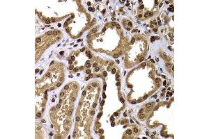 Immunohistochemistry of paraffin-embedded human kidney using GPS1 antibody at dilution of 1:100 (x400 lens). (GPS1 anticorps)
