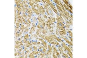 Immunohistochemistry of paraffin-embedded rat heart using POLG2 antibody (ABIN5974040) at dilution of 1/100 (40x lens). (POLG2 anticorps)