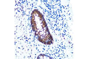Immunohistochemistry of paraffin-embedded human appendix using Galectin 3/LG Rabbit mAb (ABIN7267337) at dilution of 1:100 (40x lens).