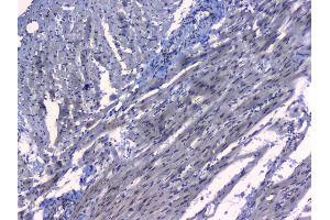 IHC analysis of MAX using anti-MAX antibody .