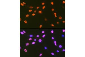 Immunofluorescence analysis of NIH-3T3 cells using EWSR1 Rabbit mAb (ABIN7267053) at dilution of 1:100 (40x lens). (EWSR1 anticorps)