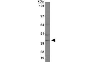 Western blot of ABHD5 in MCF-7 cell lysates using ABHD5 polyclonal antibody . (ABHD5 anticorps  (AA 200-300))