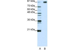 WB Suggested Anti-SF3B1 Antibody Titration:  1. (SF3B1 anticorps  (Middle Region))