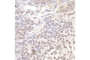 anti-Polymerase (DNA Directed), lambda (POLL) (AA 525-575) antibody