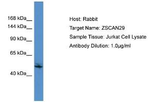 Host:  Rabbit  Target Name:  ZSCAN29  Sample Type:  Jurkat Whole Cell lysates  Antibody Dilution:  1. (ZSCAN29 anticorps  (C-Term))