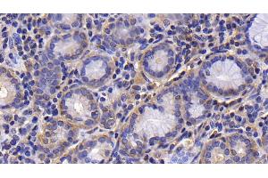 Detection of PIK3C2a in Human Stomach Tissue using Polyclonal Antibody to Phosphoinositide-3-Kinase Class-2-Alpha Polypeptide (PIK3C2a) (PIK3C2A anticorps  (AA 172-403))