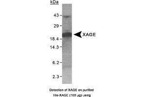 Image no. 1 for anti-X Antigen Family, Member 1D (XAGE1D) antibody (ABIN363336) (XAGE1D anticorps)