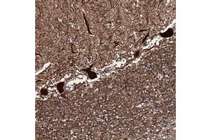 Immunohistochemical staining of human cerebellum with C18orf32 polyclonal antibody  shows strong cytoplasmic and nuclear positivity in purkinje cells at 1:20-1:50 dilution. (C18orf32 anticorps)