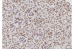 ABIN6276831 at 1/100 staining Rat kidney tissue by IHC-P. (CTBP1 anticorps  (Internal Region))