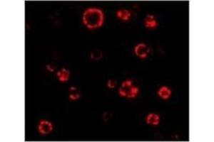 AP20063PU-N ATG16 antibody staining of HeLa Cell Lysate by Immunofluorescence at 4. (ATG16L1 anticorps  (N-Term))