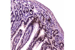 IHC analysis of BRG1 using anti-BRG1 antibody .