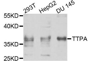 Western blot analysis of extracts of various cells, using TTPA antibody. (TTPA anticorps)