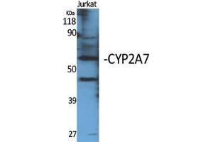 Western Blotting (WB) image for anti-Cytochrome P450, Family 2, Subfamily A, Polypeptide 7 (CYP2A7) (C-Term) antibody (ABIN3184174)