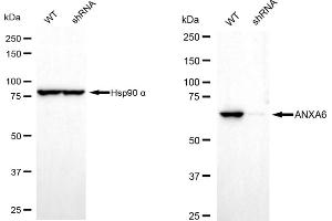 Western blotting analysis using annexin A6 antibody (ABIN7797623). (Recombinant ANXA6 anticorps)