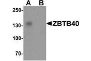 Western blot analysis of ZBTB40 in Raji cell lysate with ZBTB40 Antibody  at 0. (ZBTB40 anticorps  (N-Term))