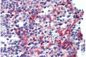 Human Spleen (formalin-fixed, paraffin-embedded) stained with PDGFRB antibody ABIN462353 followed by biotinylated anti-mouse IgG secondary antibody ABIN481714, alkaline phosphatase-streptavidin and chromogen. (PDGFRB anticorps)