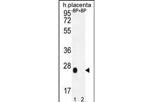 Western blot analysis of OR2J3 Antibody Pab pre-incubated without(lane 1) and with(lane 2) blocking peptide in human placenta tissue lysate. (OR2J3 anticorps  (C-Term))