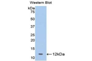 Western Blotting (WB) image for anti-2',5'-Oligoadenylate Synthetase 1, 40/46kDa (OAS1) (AA 74-165) antibody (ABIN1175790) (OAS1 anticorps  (AA 74-165))