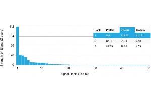 Analysis of Protein Array containing more than 19,000 full-length human proteins using Growth Hormone Mouse Monoclonal Antibody (GH/1371).