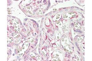 Anti-RARRES3 antibody IHC of human placenta. (RARRES3 anticorps  (AA 124-136))