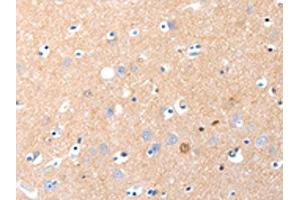 The image on the left is immunohistochemistry of paraffin-embedded Human brain tissue using ABIN7190883(GRM1 Antibody) at dilution 1/15, on the right is treated with synthetic peptide.