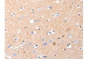 The image on the left is immunohistochemistry of paraffin-embedded Human brain tissue using ABIN7190883(GRM1 Antibody) at dilution 1/15, on the right is treated with synthetic peptide. (Metabotropic Glutamate Receptor 1 anticorps)