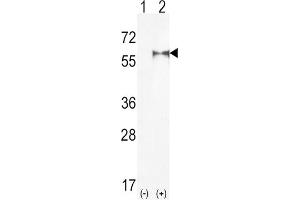 Western Blotting (WB) image for anti-Phosphatidylinositol-4-Phosphate 5-Kinase, Type I, alpha (PIP5K1A) antibody (ABIN3003646) (PIP5K1A anticorps)