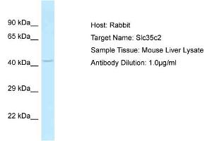 Host: Rabbit Target Name: SLC35C2 Sample Tissue: Mouse Liver Antibody Dilution: 1ug/ml (SLC35C2 anticorps  (C-Term))