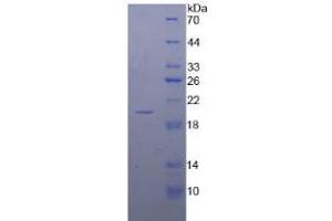 SDS-PAGE analysis of Human Calmodulin Protein.
