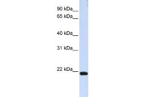 WB Suggested Anti-TJAP1 Antibody Titration:  0. (TJAP1 anticorps  (N-Term))