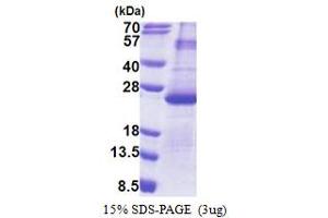 SDS-PAGE (SDS) image for Dual Specificity Phosphatase 26 (DUSP26) (AA 1-211) protein (His tag) (ABIN5853235)