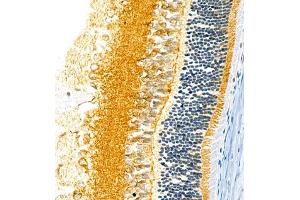 Immunohistochemistry of paraffin embedded rat eye using FGF11 (ABIN7073941) at dilution of 1:2200 (400x lens)