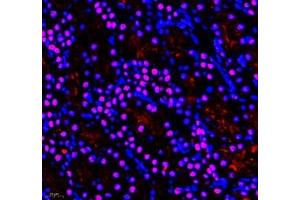 Immunofluorescence of paraffin embedded rat kidney using GTF3C3 (ABIN7074039) at dilution of 1: 650 (400x lens)