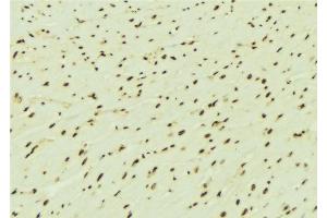ABIN6276442 at 1/100 staining Mouse brain tissue by IHC-P. (RPA1 anticorps  (Internal Region))