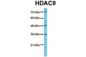Host:  Rabbit  Target Name:  HDAC9  Sample Tissue:  Human Fetal Brain  Antibody Dilution:  1.