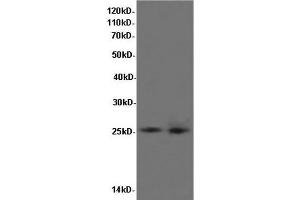 Western Blot analysis of K562 cells and Rat liver tissue using BCL-x Polyclonal Antibody at dilution of 1:600 (BCL2L1 anticorps)