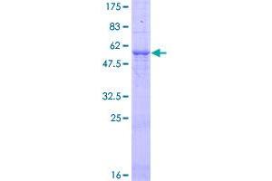 Image no. 1 for Tumor Necrosis Factor, alpha-Induced Protein 3 (TNFAIP3) (AA 1-248) protein (GST tag) (ABIN1323128)