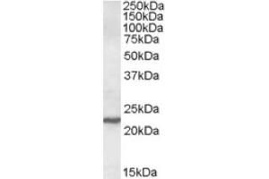 Image no. 1 for anti-SAR1 Homolog A (SAR1A) (Internal Region) antibody (ABIN375021)