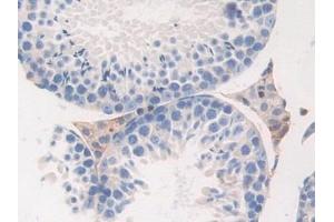 Detection of FGB in Mouse Testis Tissue using Polyclonal Antibody to Fibrinogen Beta Chain (FGB)