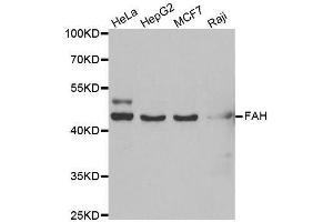 Western blot analysis of extracts of various cell lines, using FAH antibody. (FAH anticorps  (AA 1-419))